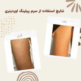 سرم پیلینگ اوردینری ۳۰ میلی لیتر